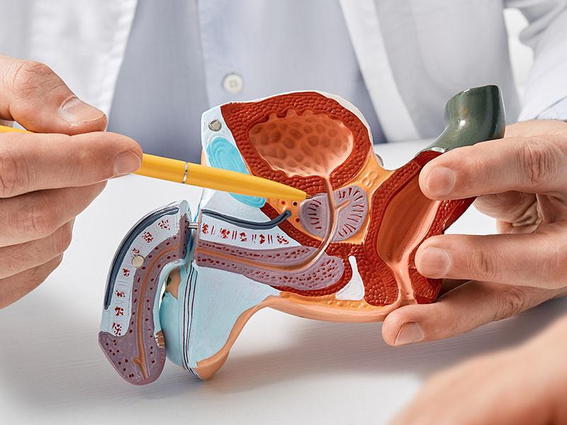 What Fuels Prostate Cancer? | Dr. Tushar Patil Explains Androgen Deprivation Therapy & CRPC